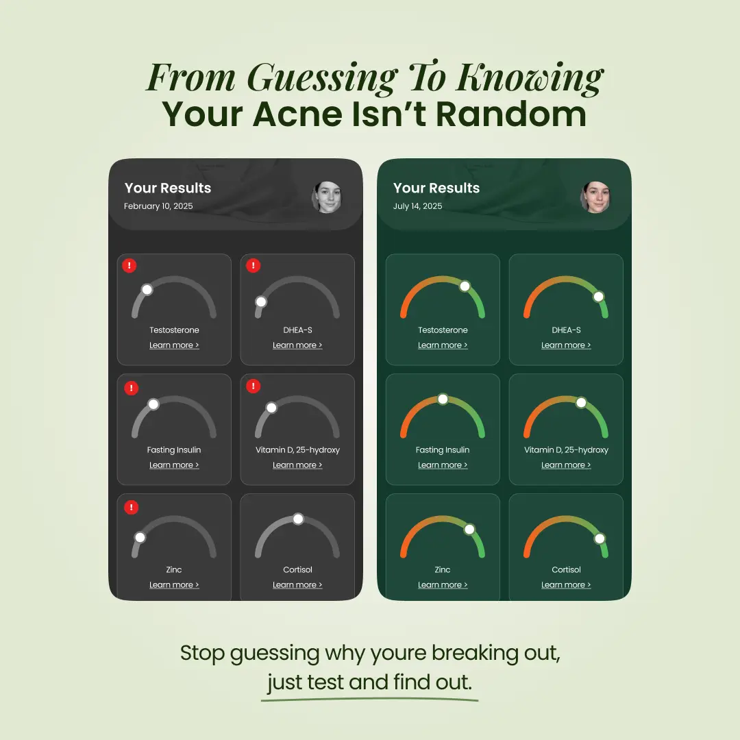 BreakoutLabs Acne Root Cause Test BreakoutLabs