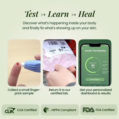 BreakoutLabs Acne Root Cause Test BreakoutLabs