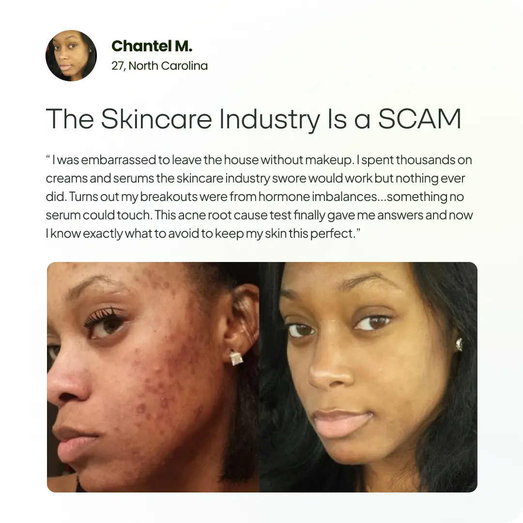 Acne Root Cause Test Kit BreakoutLabs