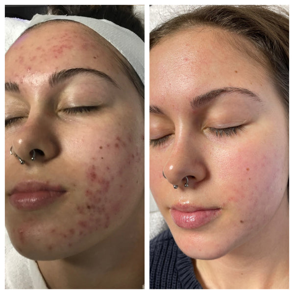 Priya K. | Verified Customer