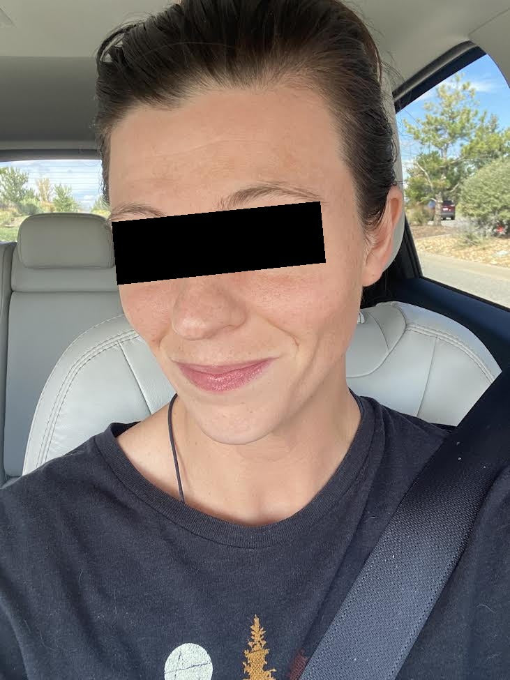Lindsay P., smiling in a car with clear-looking skin before her wedding